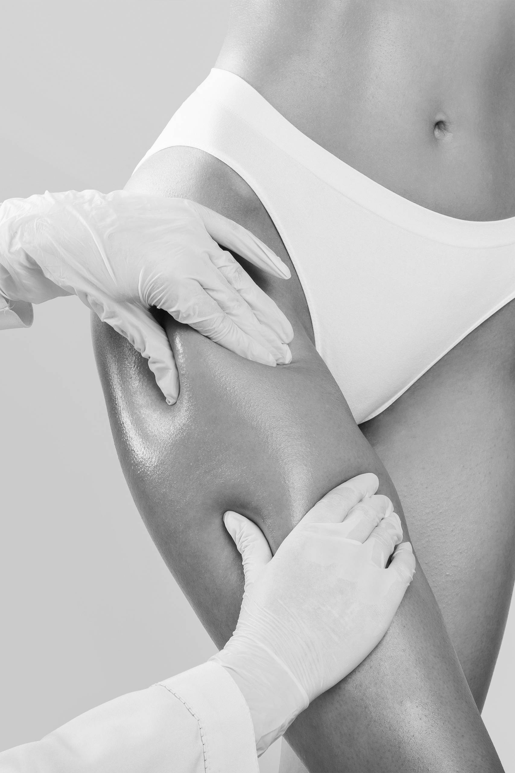 Lifting brate si coapse 2