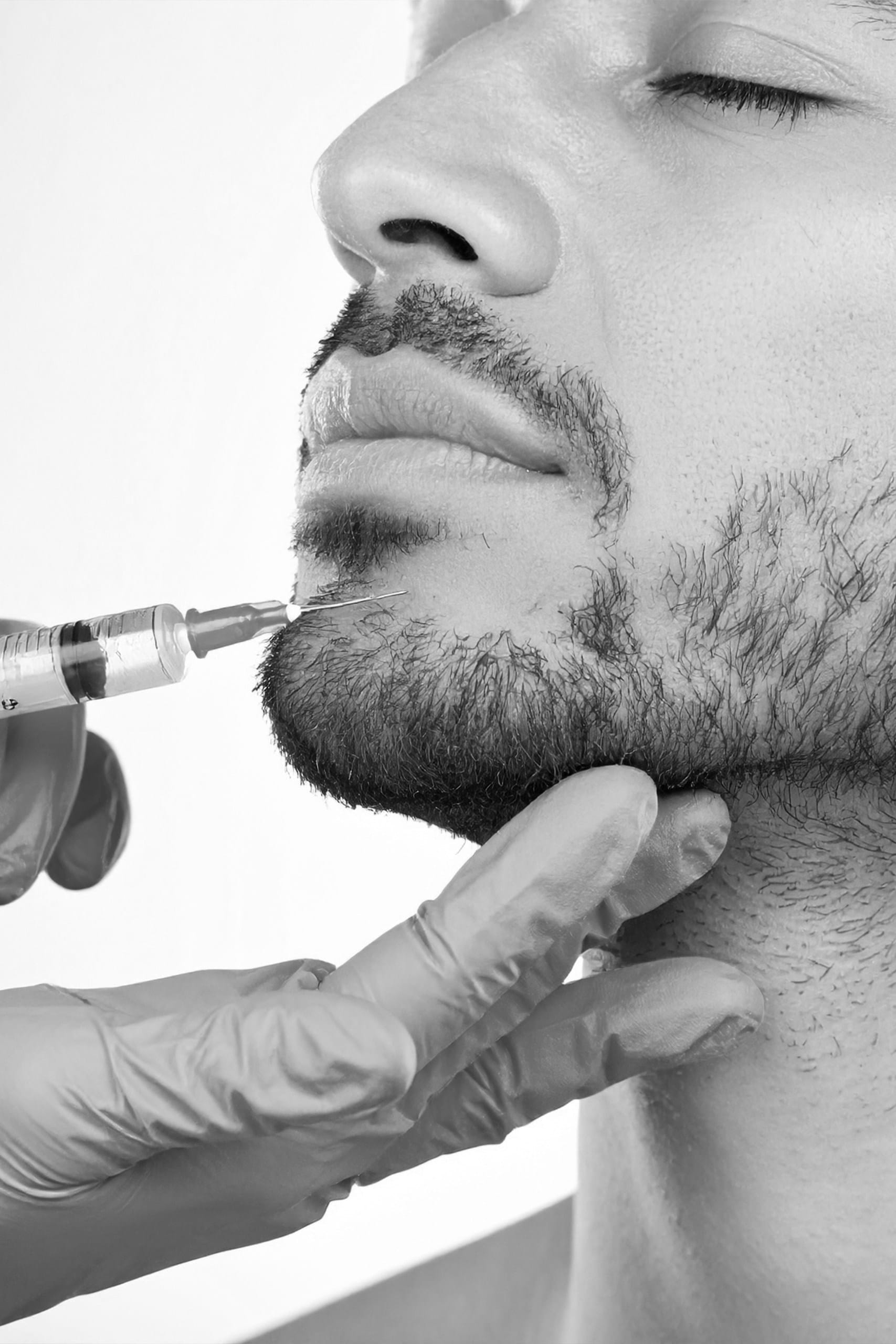 Acid deoxicolic pentru topire grasime localizata 3