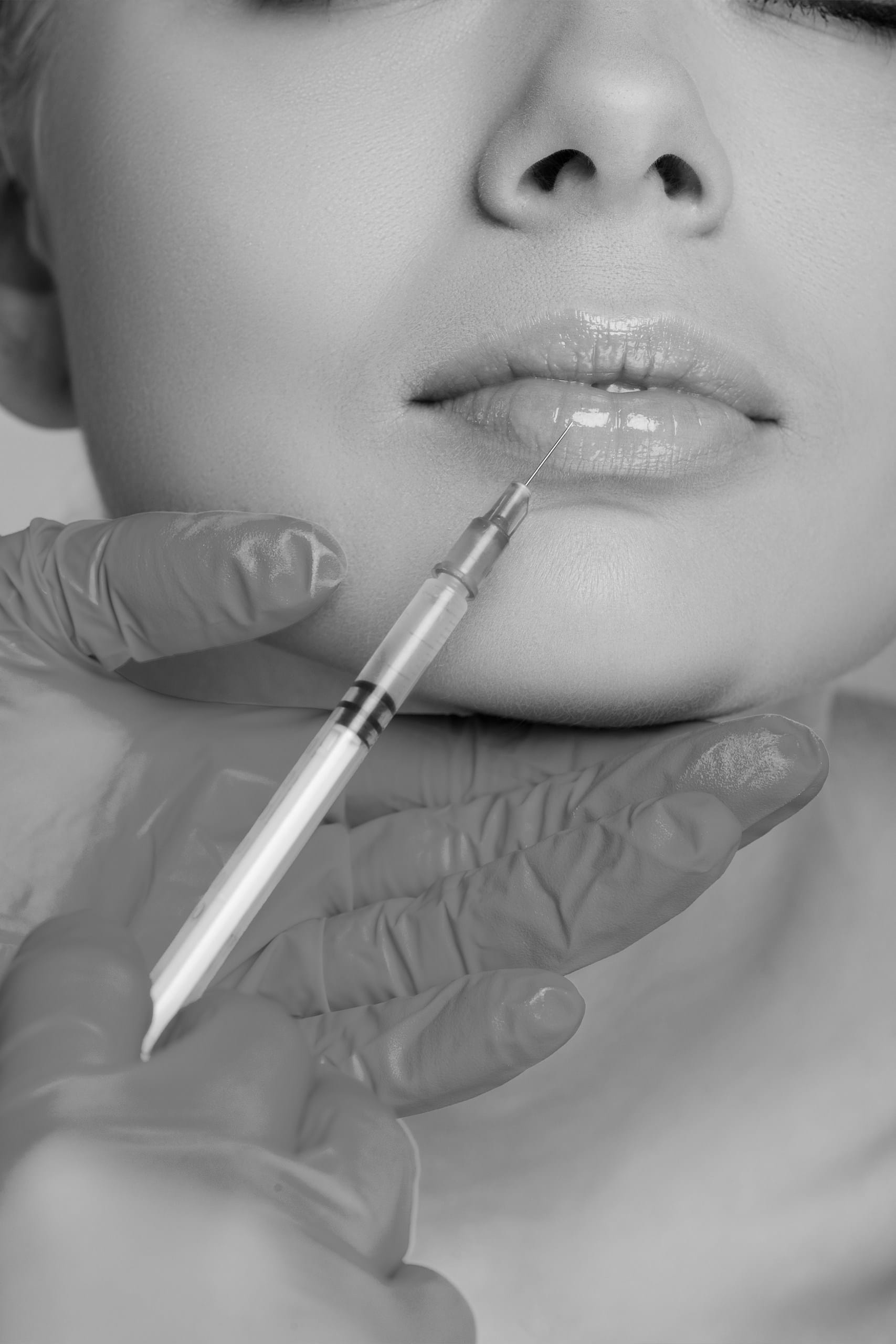 Augmentarea buzelor 1