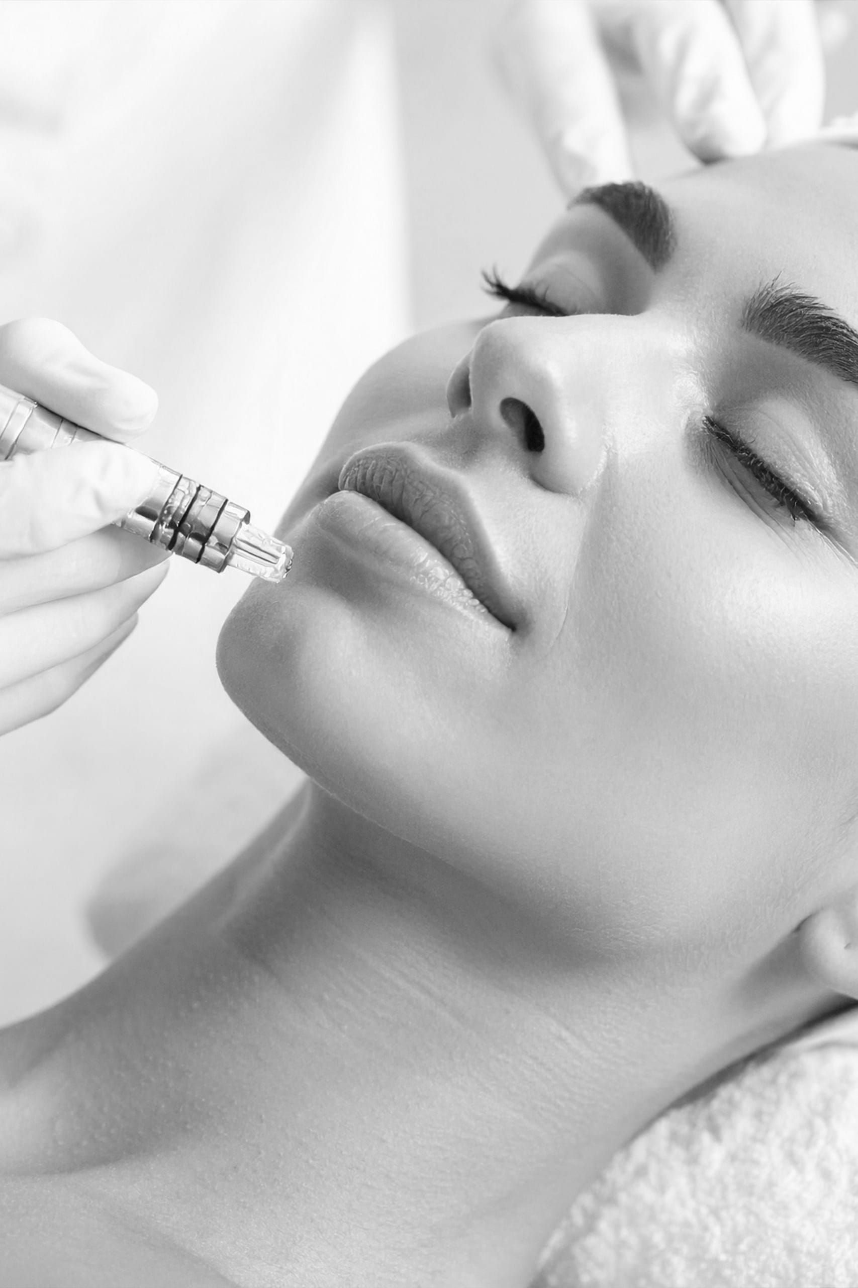 Microdermabraziune 1