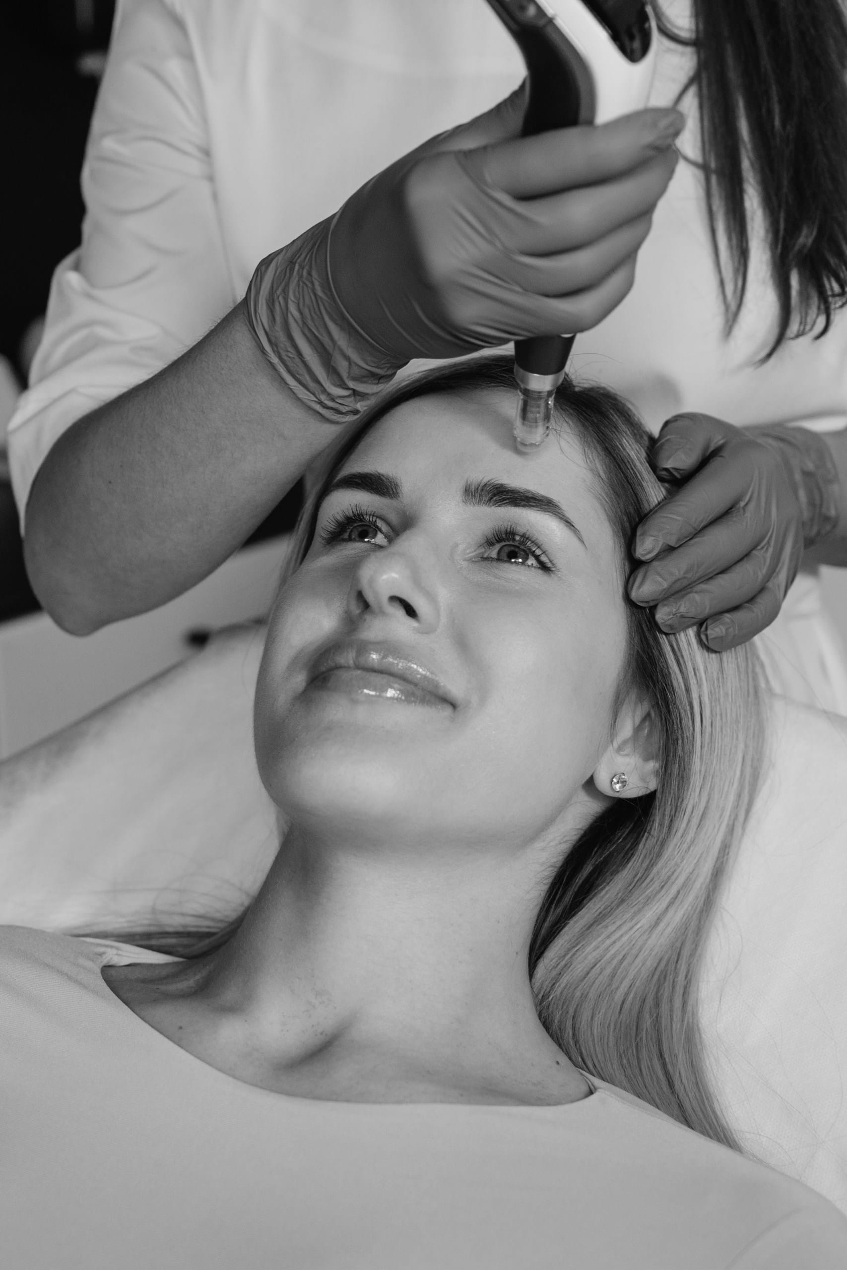 Microdermabraziune 2