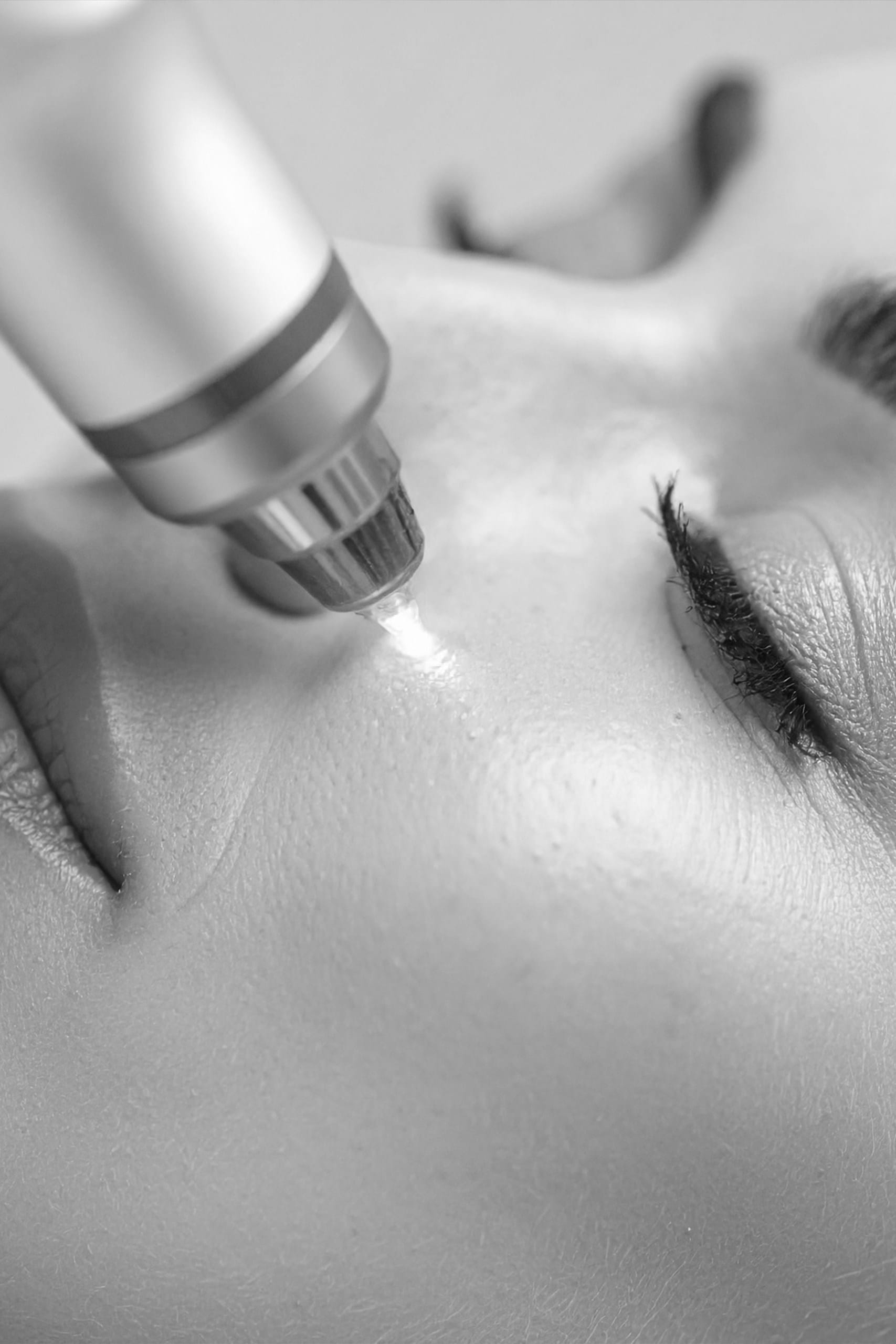 Rejuvenare cu laser CO2​ 2