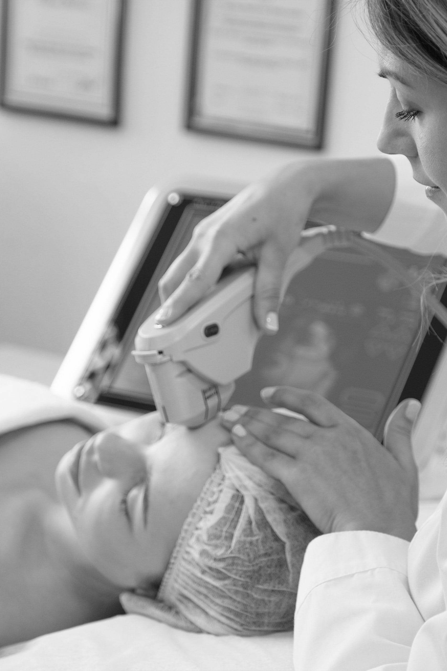 Rinoplastie ultrasonica 2