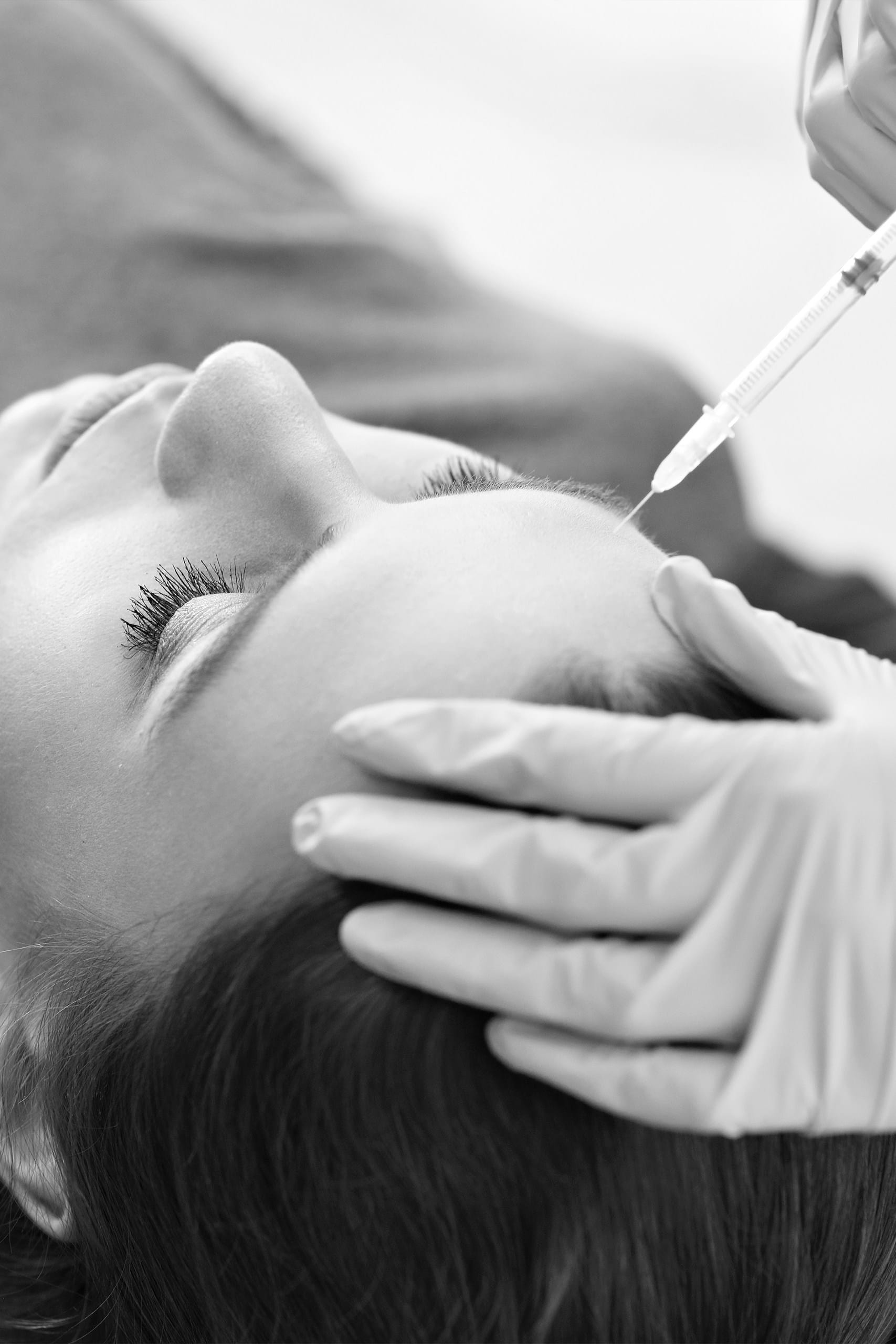 Mezoterapie cu acid hialuronic si vitamine 1