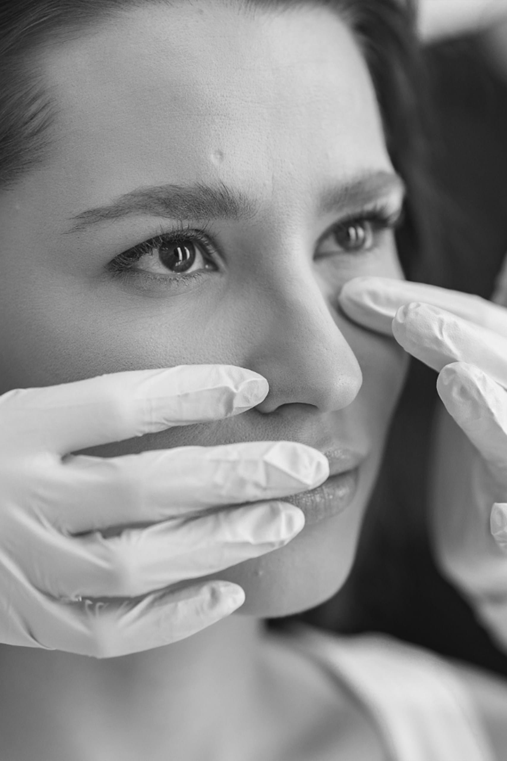 Lifting endoscopic ponytail facelifting 3