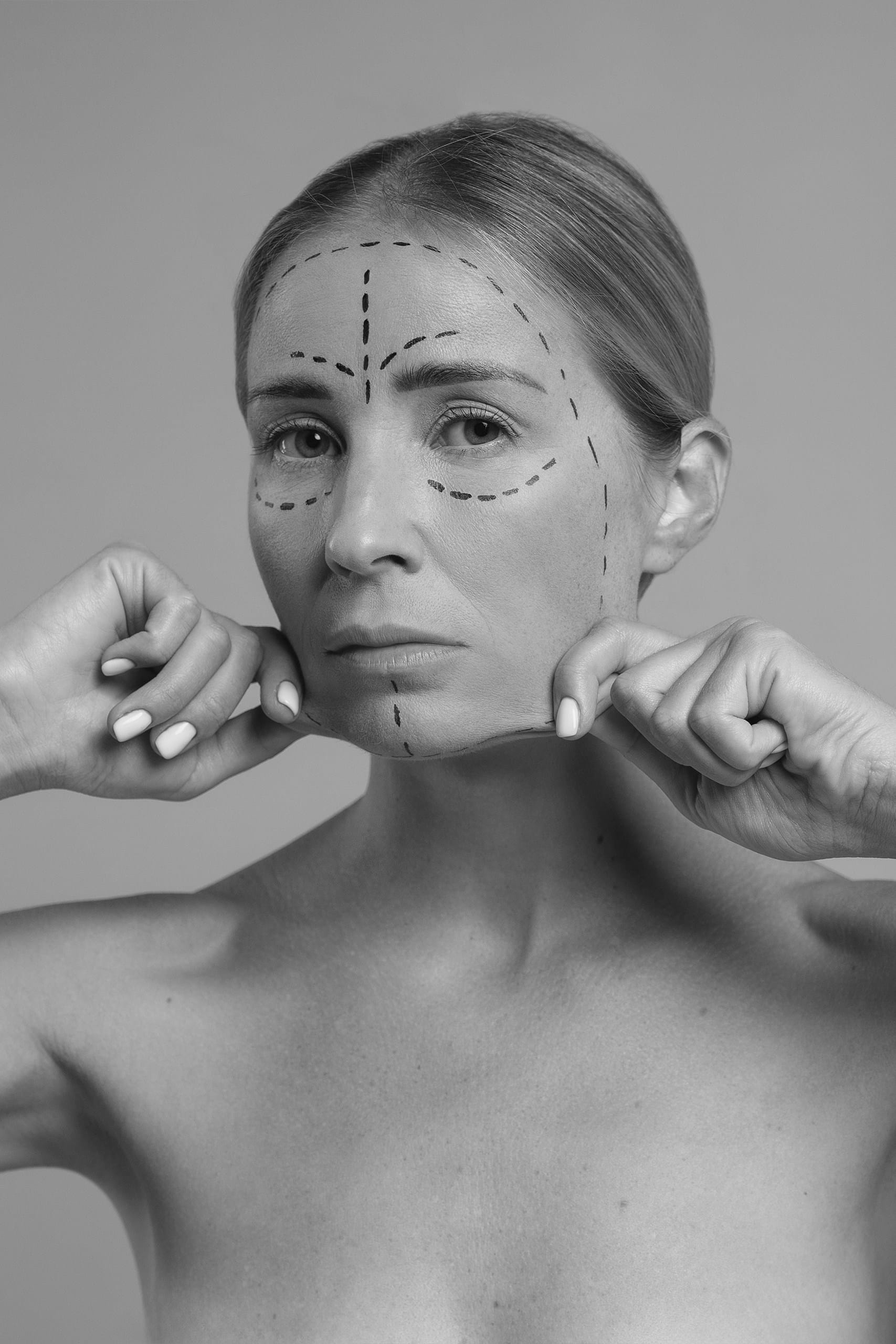 Lifting facial minim invaziv nonchirurgical cu FaceTite si AccuTite 2