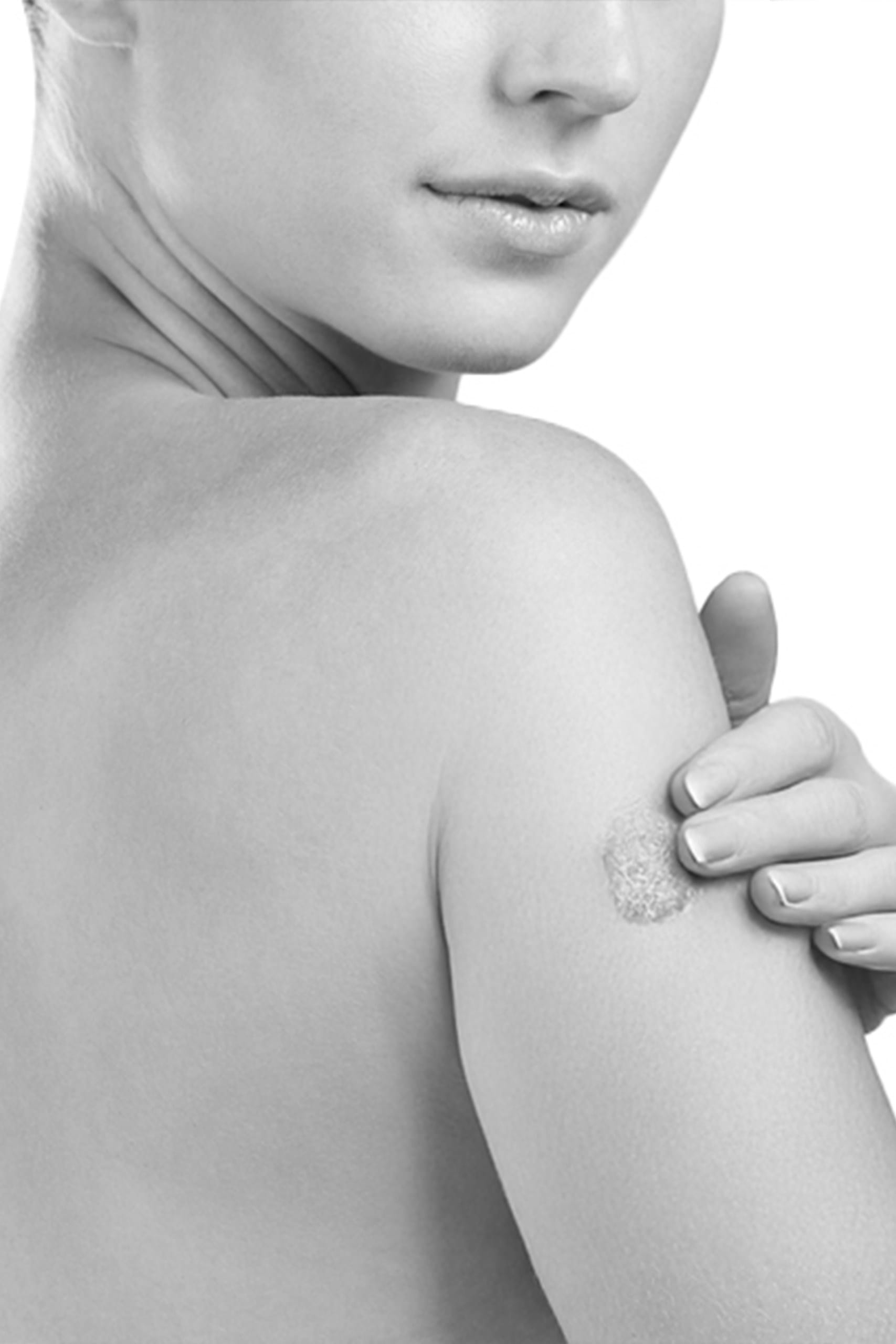 Reconstructie post excizie tumori cutanate 1