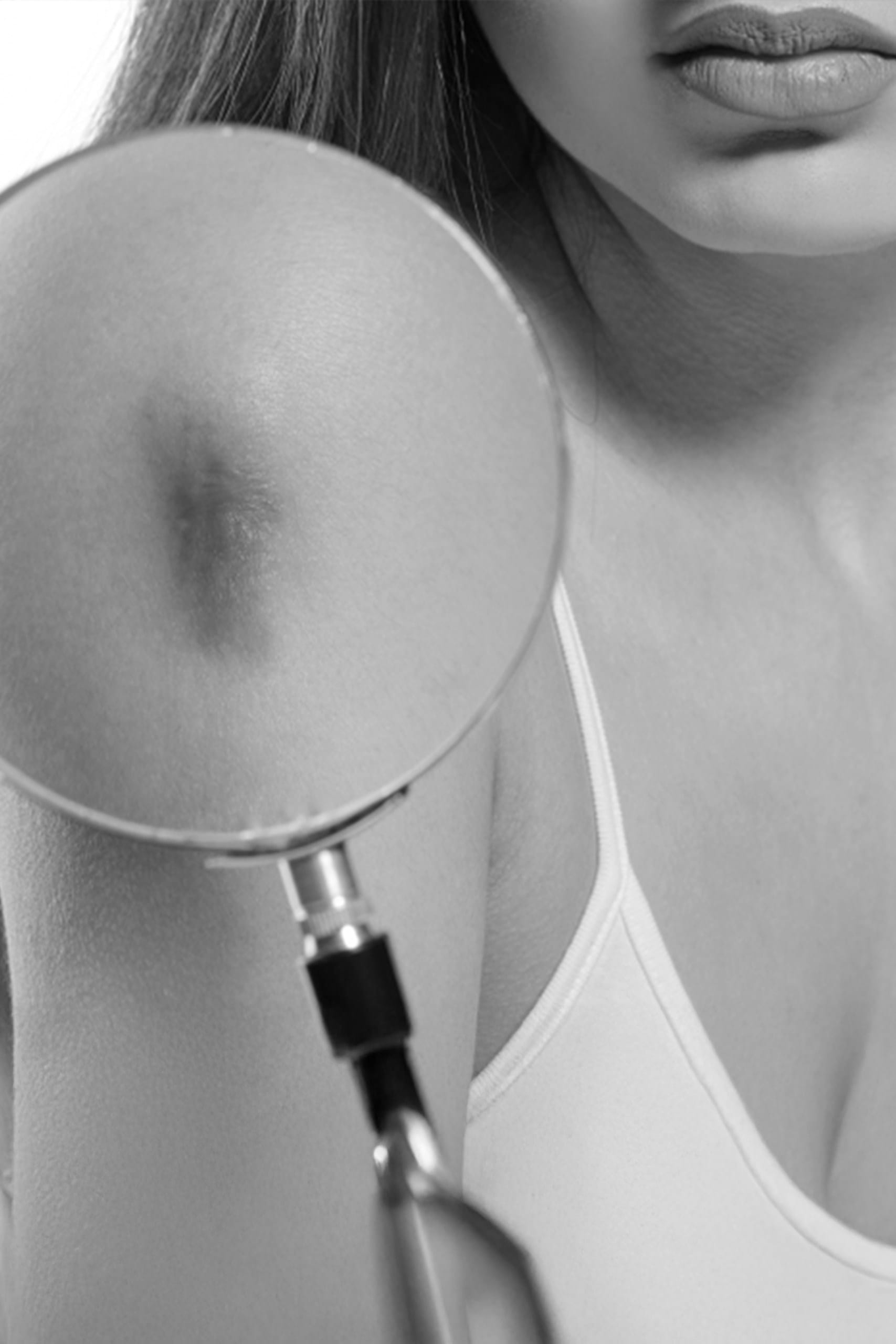 Reconstructie post excizie tumori cutanate 3