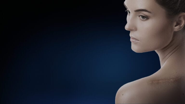 Reconstrucție post excizie tumori cutanate