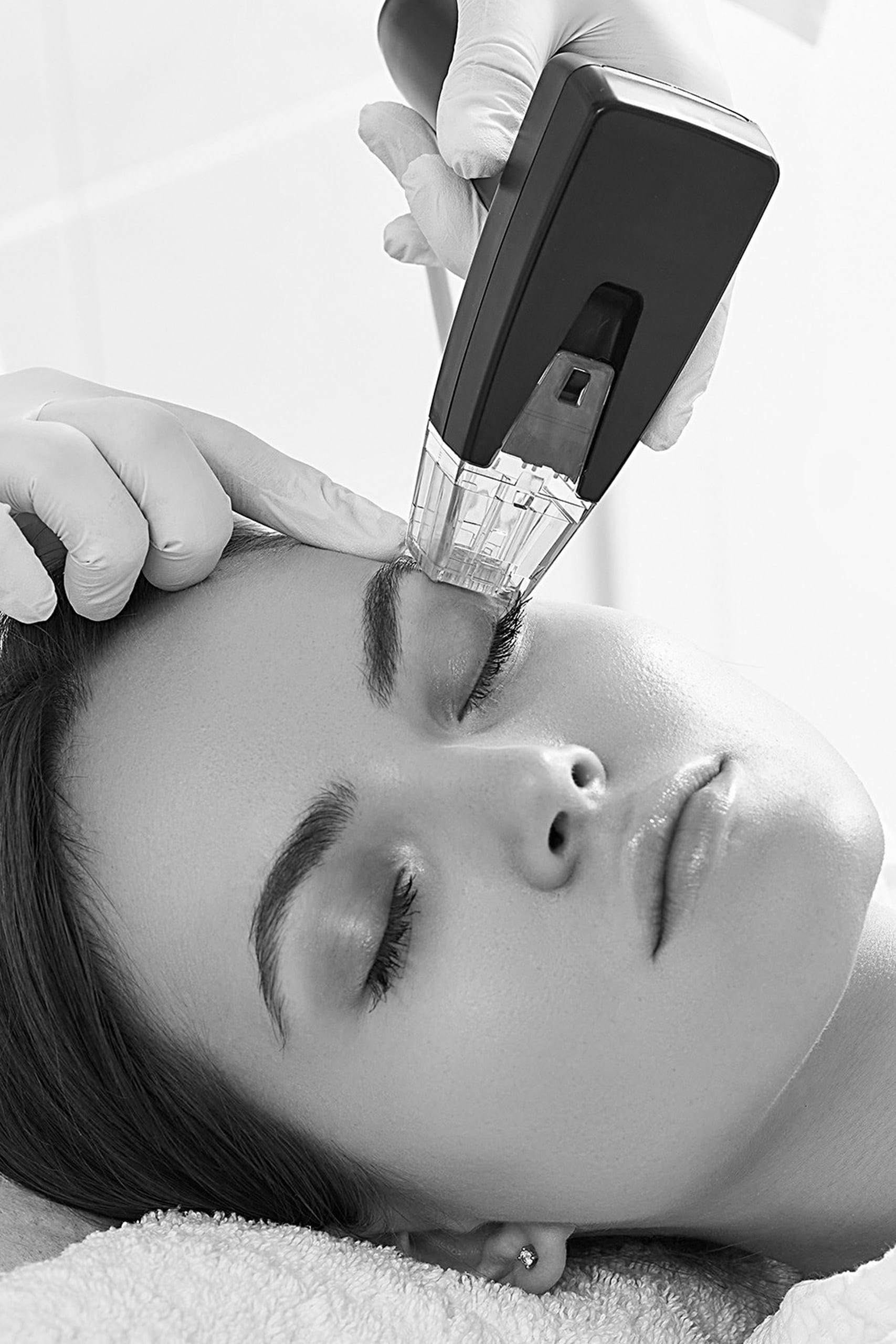 Rejuvenare faciala non chirurgicala cu Morpheus8 1