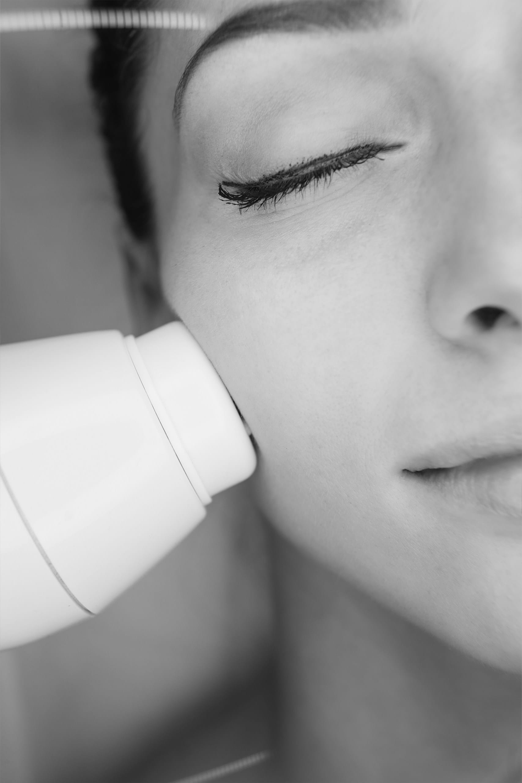 Rejuvenare faciala non chirurgicala cu laserul dioda MeDioStar Asclepion 3