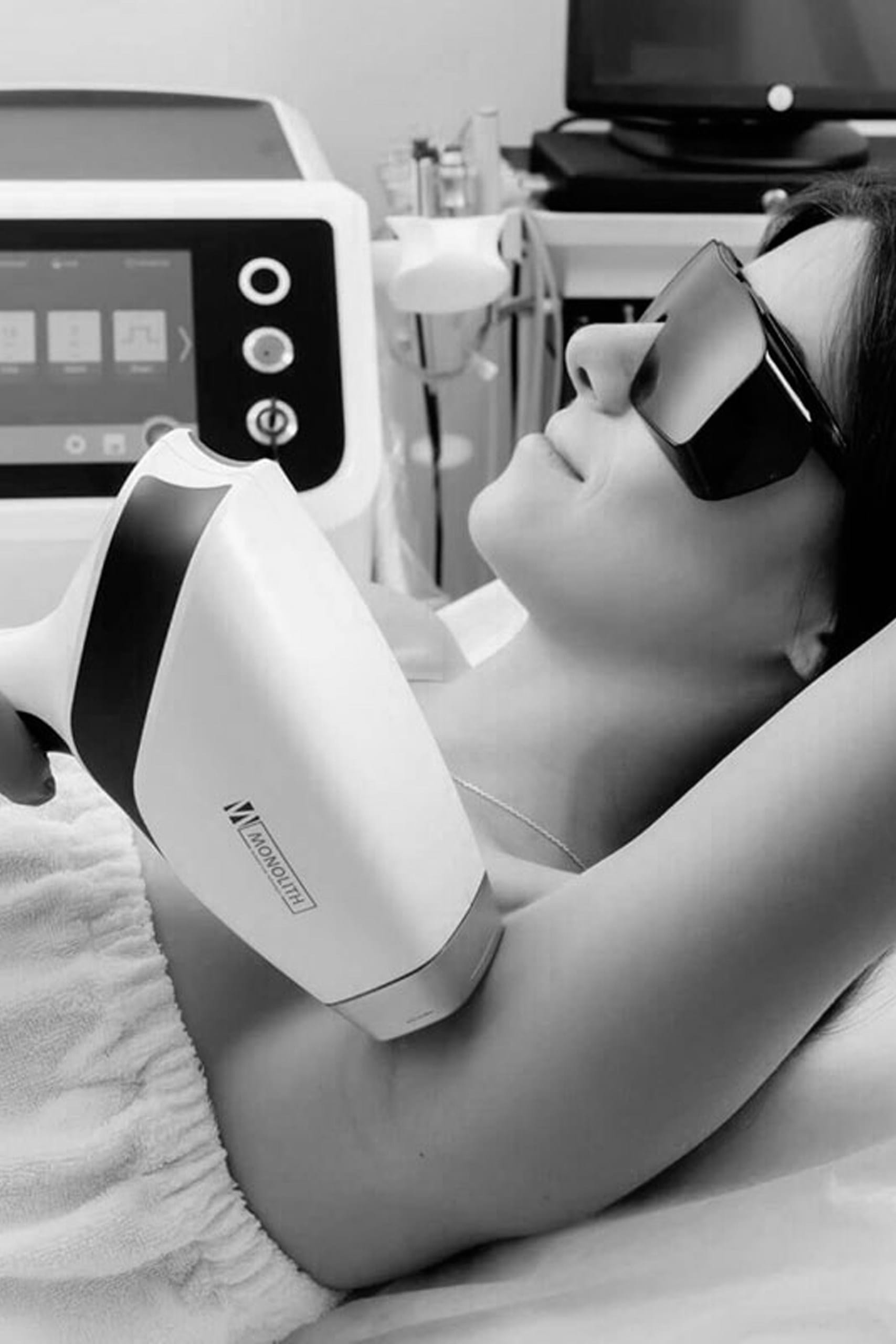 Tratamentul leziunilor pigmentare cu laser dioda MeDioStar Asclepion 2