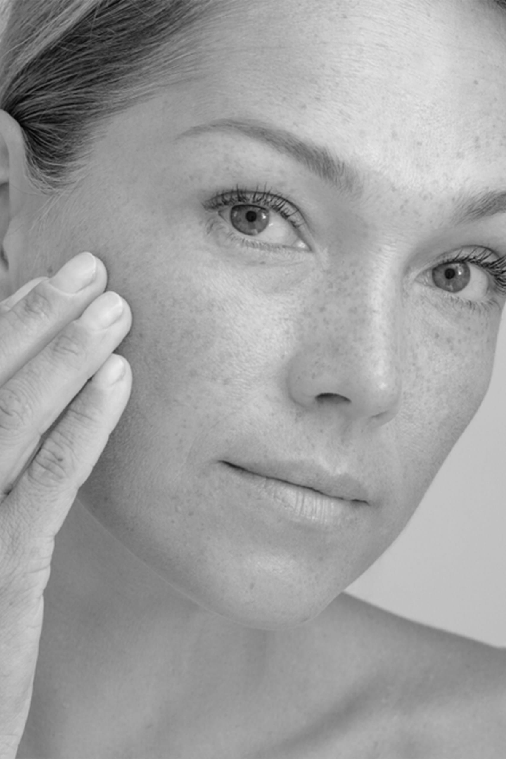 Tratamentul leziunilor pigmentare cu laser dioda MeDioStar Asclepion 3