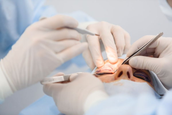 How to Choose the Best Clinic for Blepharoplasty 1 How to Choose the Best Clinic for Blepharoplasty