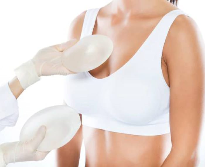 Implant anatomic vs rotund. Care este alegerea potrivită?