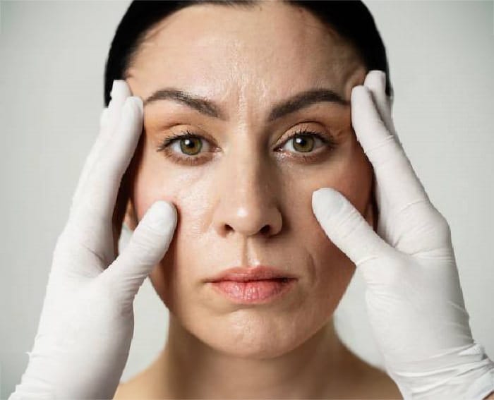 Tipuri de lifting facial. Beneficii și indicații pentru fiecare