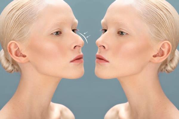 drolimpiuharceaga remodelare nas 1