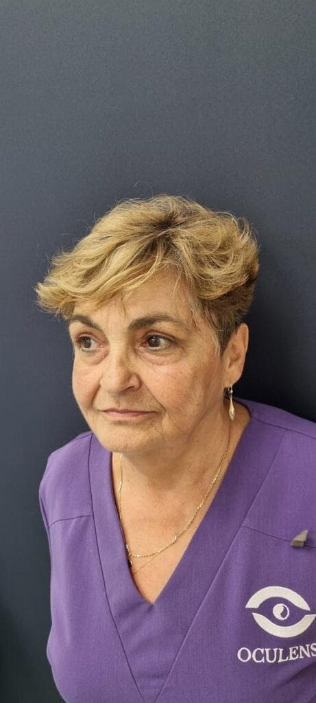 Gallery 321 Cazul nr. 6 - Blefaroplastie superioară - Oh