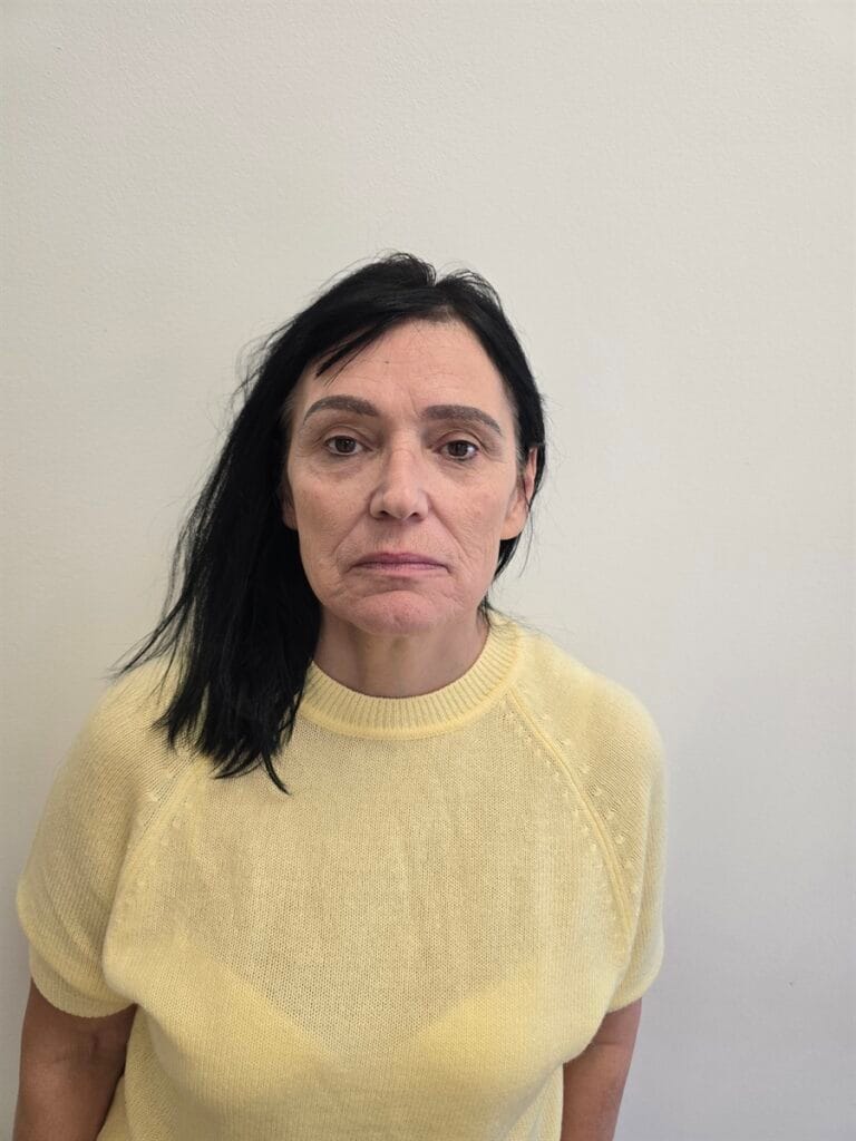 Gallery 394 Cazul nr. 3 - Lifting facial - Oh