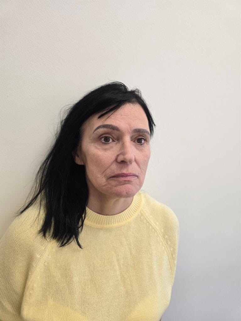 Gallery 396 Cazul nr. 3 - Lifting facial - Oh