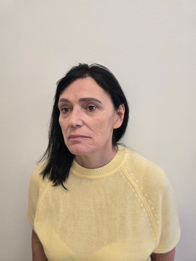 Gallery 398 Cazul nr. 3 - Lifting facial - Oh