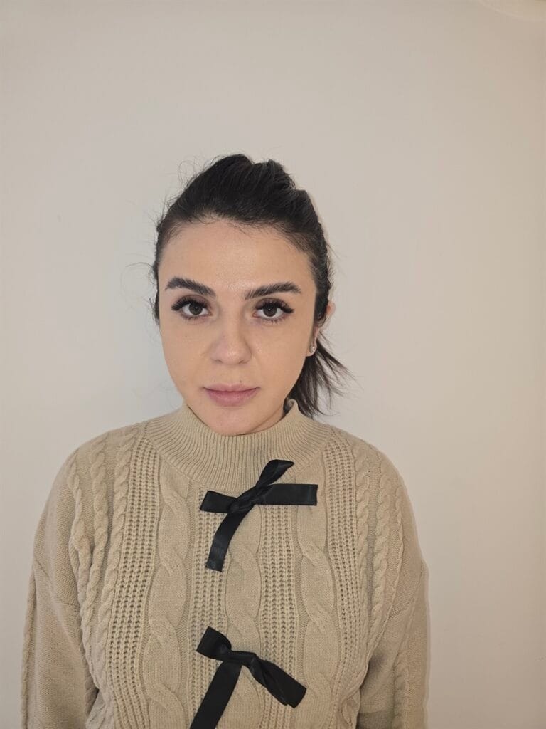 Gallery 491 Cazul nr. 2 - Liposucție gât - Oh