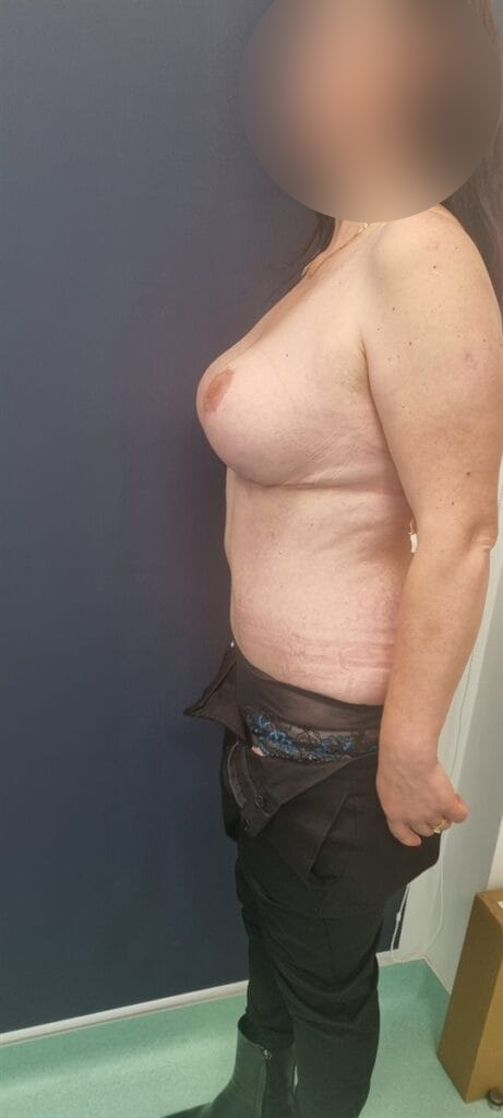 Gallery 499 Cazul nr. 1 - Mommy make over - Oh