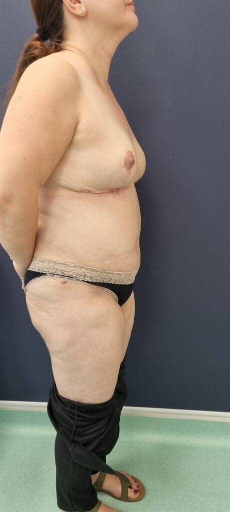 Gallery 531 Cazul nr. 6 - Mommy make over - Oh