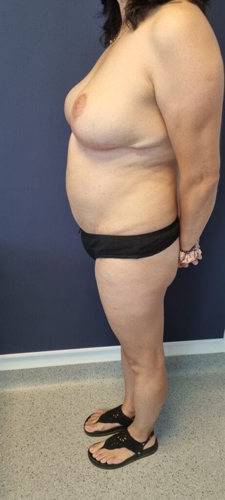 Gallery 535 Cazul nr. 7 - Mommy make over - Oh