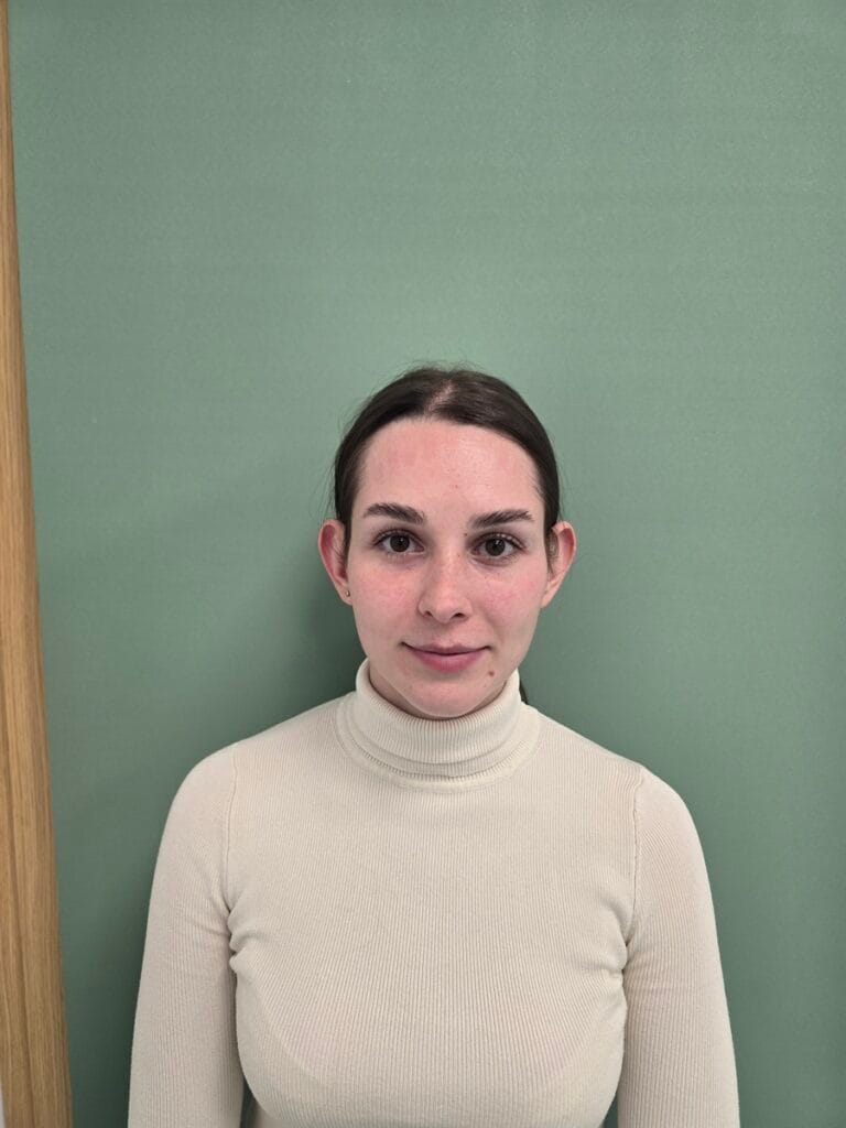 Cazul nr. 1 - Otoplastie - Oh