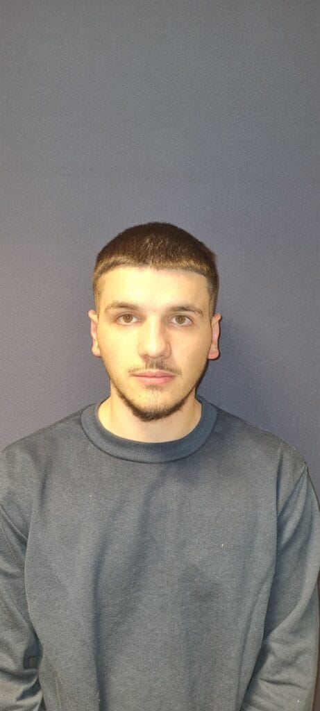 Cazul nr. 3 - Otoplastie - Oh